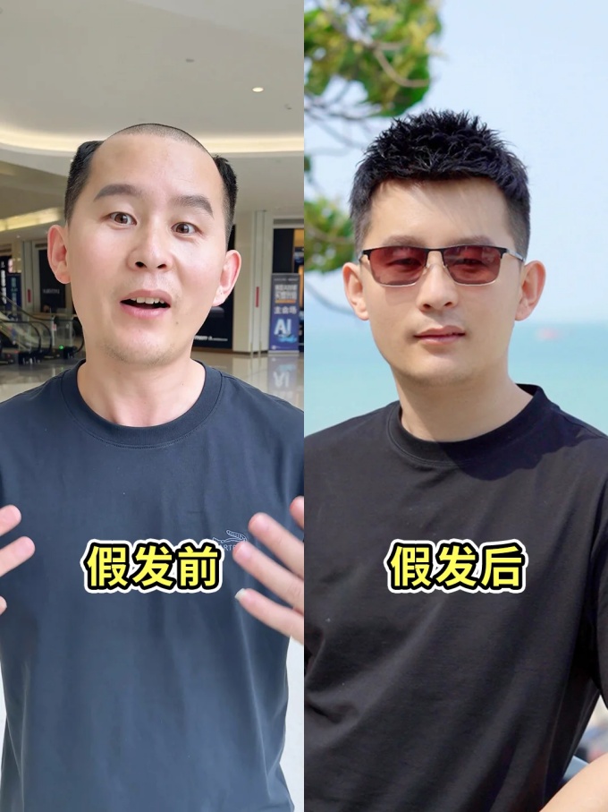 廈門假發(fā)店,靠譜的假發(fā)店 \