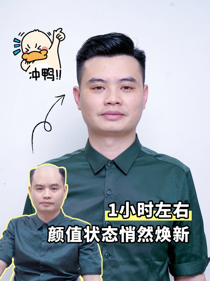 石家莊假發(fā),假發(fā)1小時定制 \