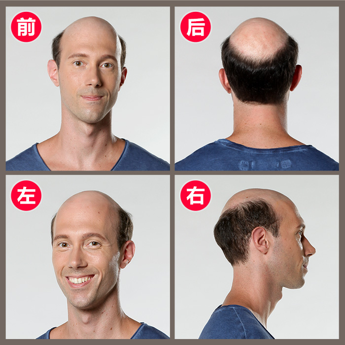 石家莊真人假發(fā)如何選？什么牌子值得推薦？