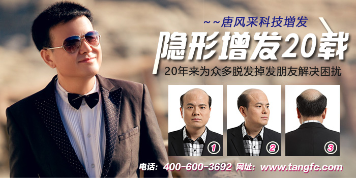 北京織發(fā)補發(fā)哪家好？怎么收費？